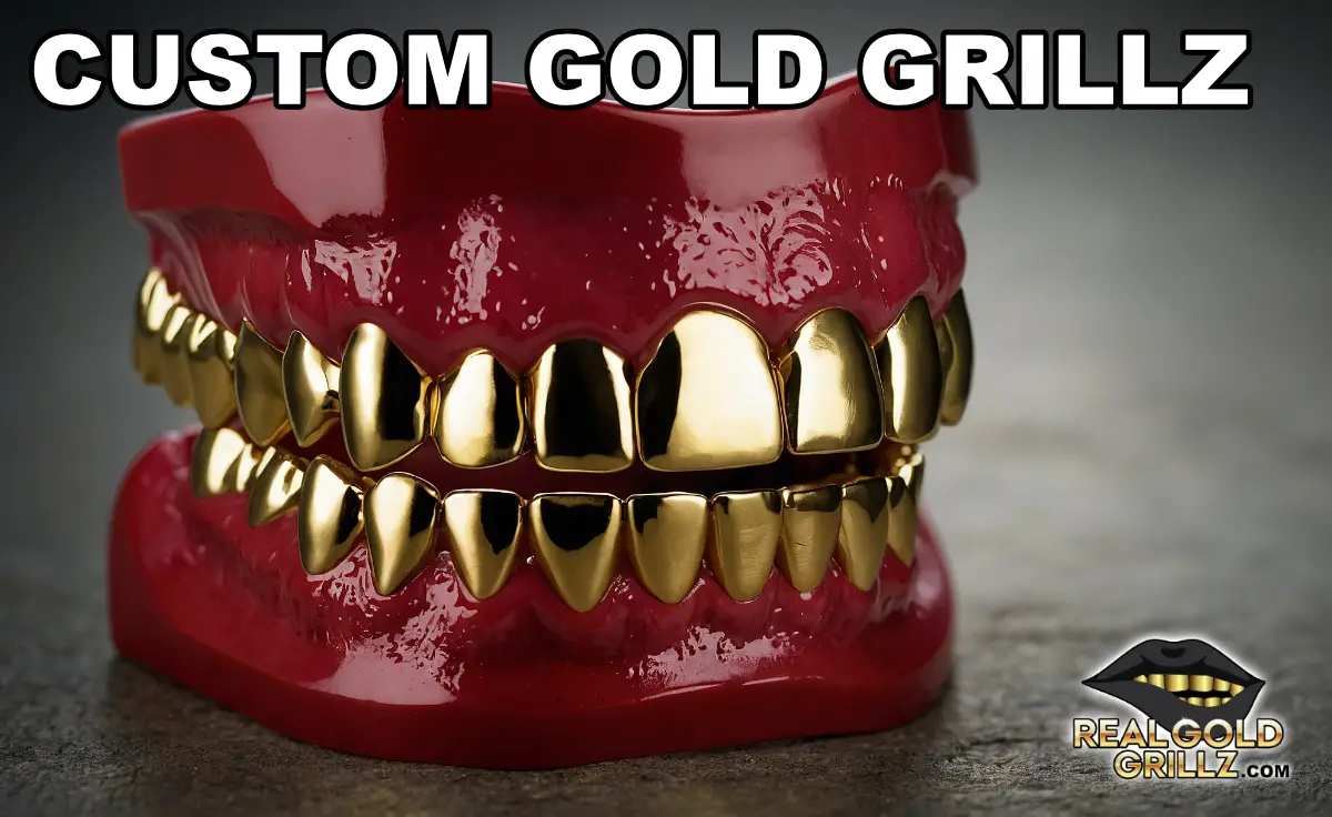 custom gold grillz